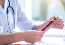 AVC précoce : voici le groupe sanguin qui comporte le plus de risques